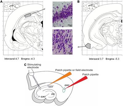 Maternal Hypoxia Increases the Excitability of Neurons in the Entorhinal Cortex and Dorsal Hippocampus of Rat Offspring